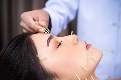 Cosmetic Acupuncture Bloomington MN